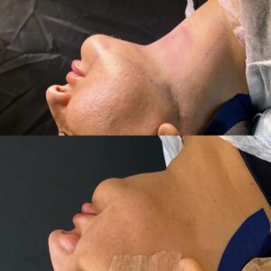 433083131_18227173573261672_3996206590842796977_n